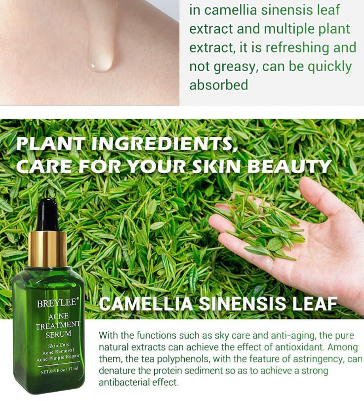 Acne Treatment Serum Facial Repair Oil Acne Treatment Serum Facial Repair Oil